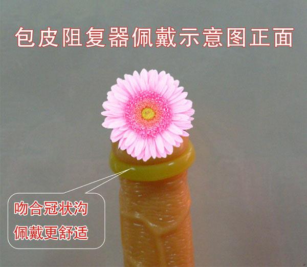 做手术可以刷医保卡吗 包皮手术可以刷医保吗